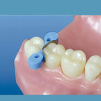 Steriltex Elastic (Silicone) wedges