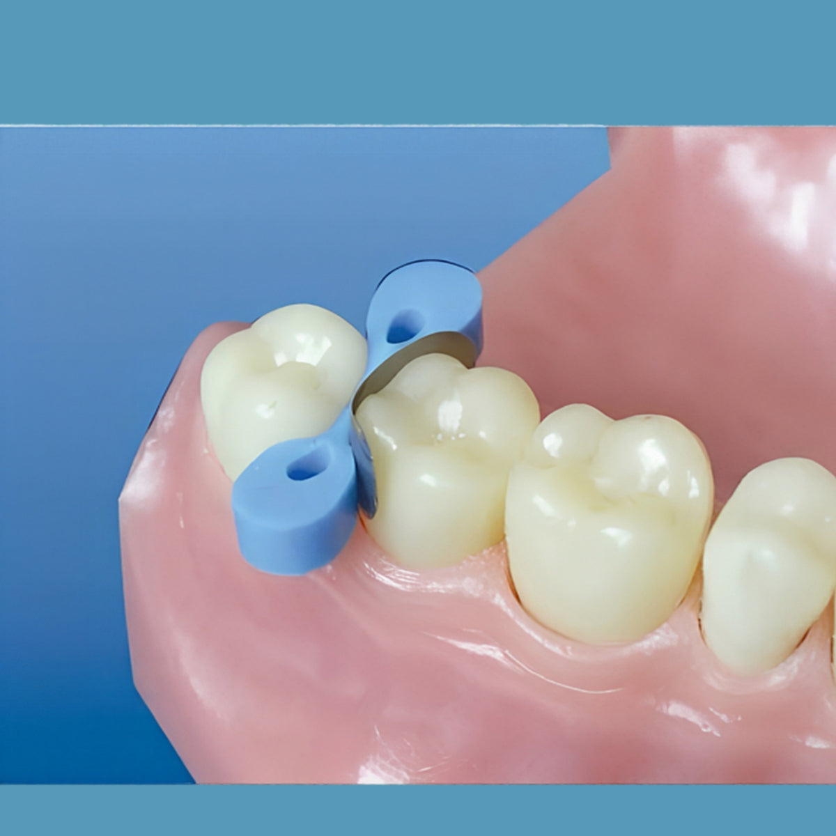 Steriltex Elastic (Silicone) wedges