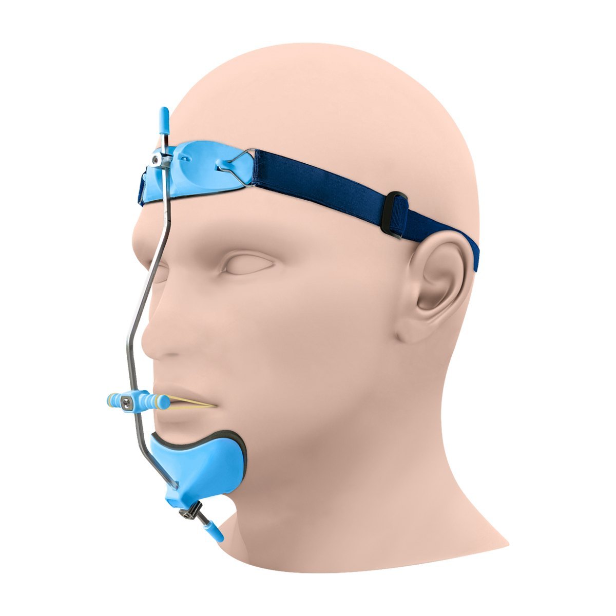 Reverse pull head gear kit